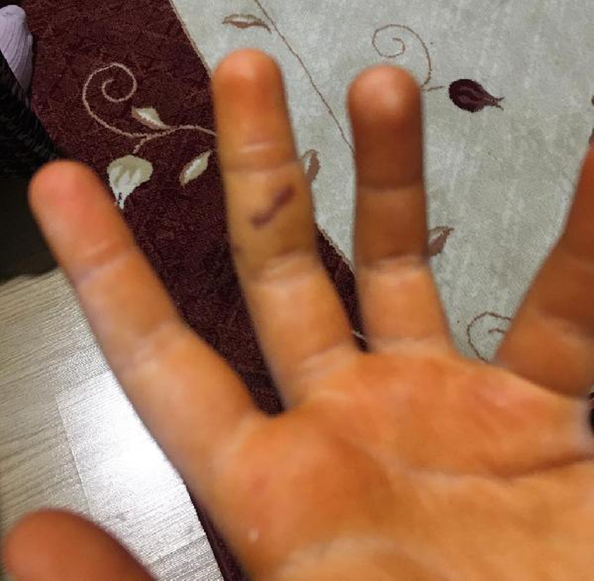 Köpeklerin saldırdığı Özge, yaralandı