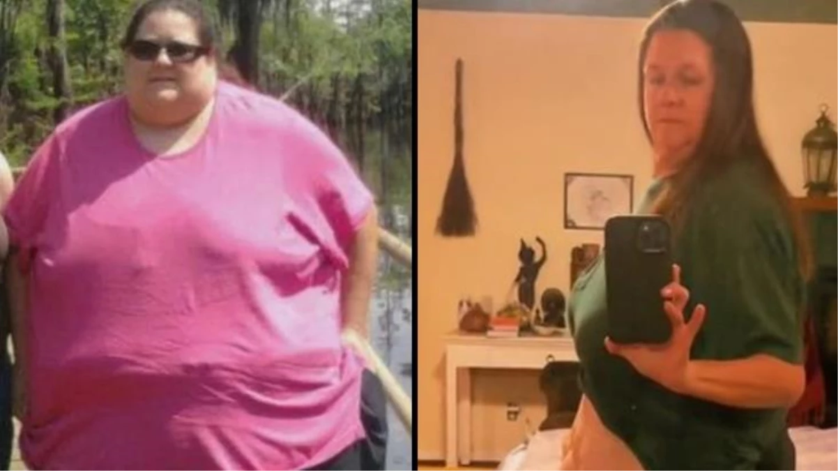 270 kilodan 167\'ye düşen ABD\'li kadının inanılmaz değişimi! Sarkan derisi dizlerine kadar indi