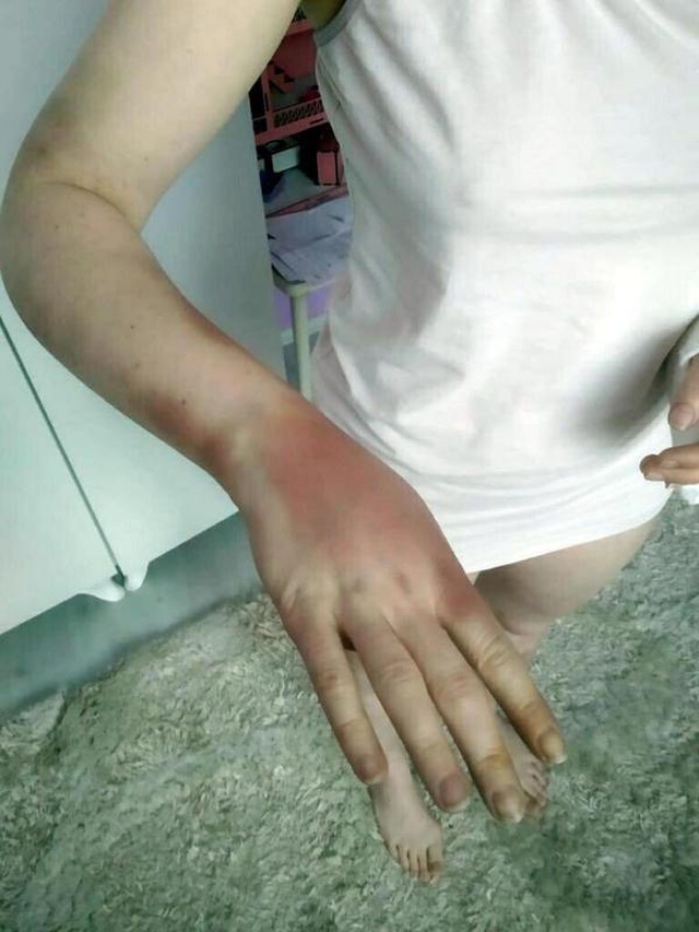 Genç kıza işkence edip, çıplak fotoğraflarını yaymakla tehdit eden şahıs cezasız kalmadı Genç kıza işkence edip, çıplak fotoğraflarını yaymakla tehdit eden şahıs cezasız kalmadı