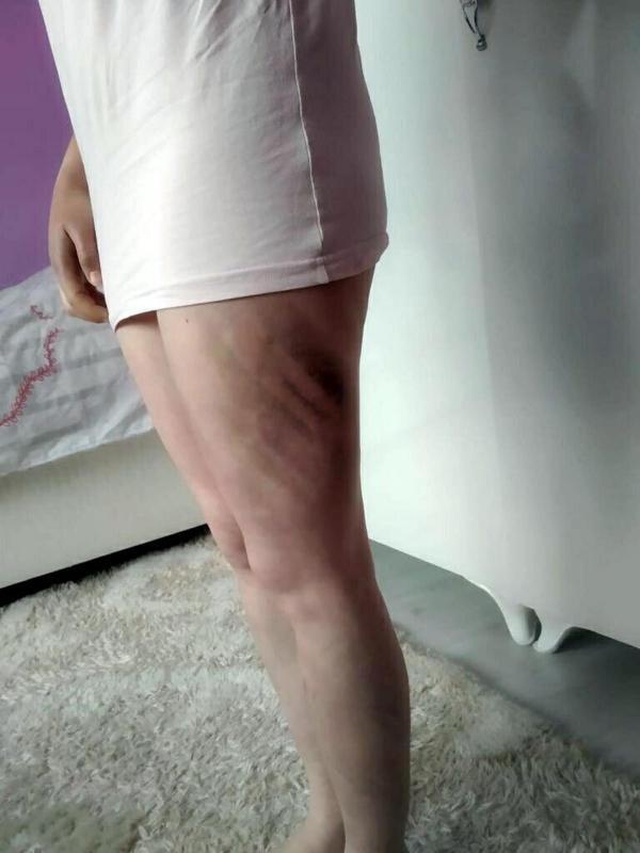 Genç kıza işkence edip, çıplak fotoğraflarını yaymakla tehdit eden şahıs cezasız kalmadı Genç kıza işkence edip, çıplak fotoğraflarını yaymakla tehdit eden şahıs cezasız kalmadı