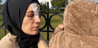 Konuşmadığı eşinin cinsel ilişki teklifini reddeden kadın, kocası tarafından öldüresiye dövüldü