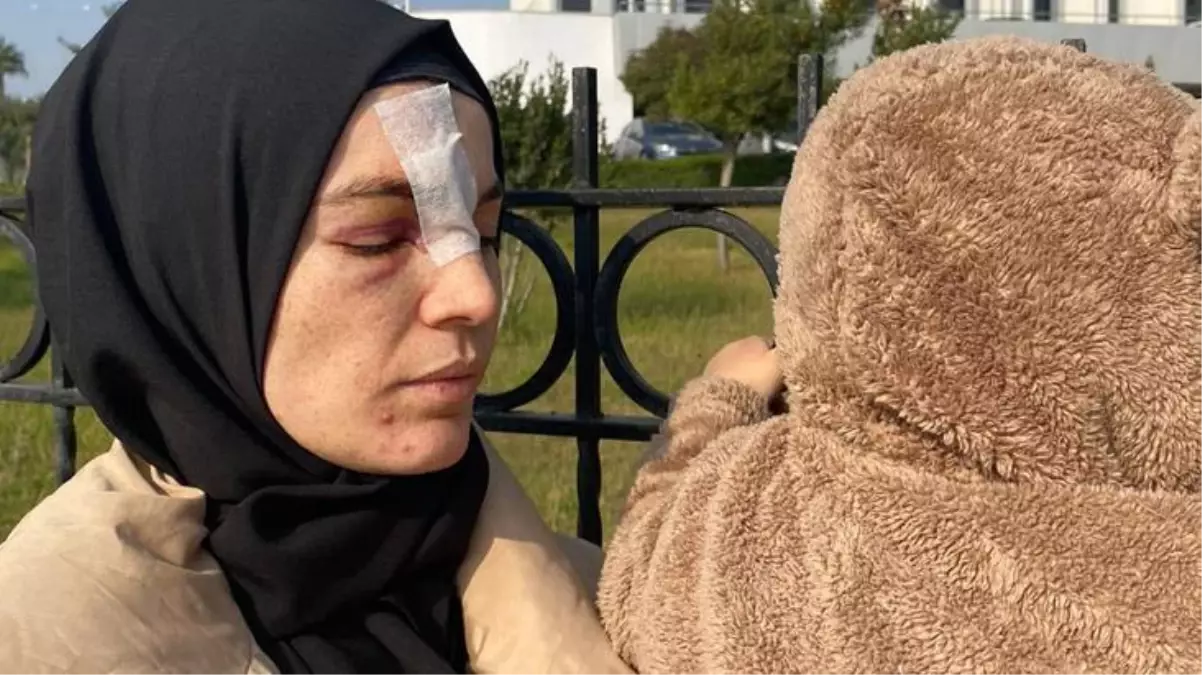 Konuşmadığı eşinin cinsel ilişki teklifini reddeden kadın, kocası tarafından öldüresiye dövüldü