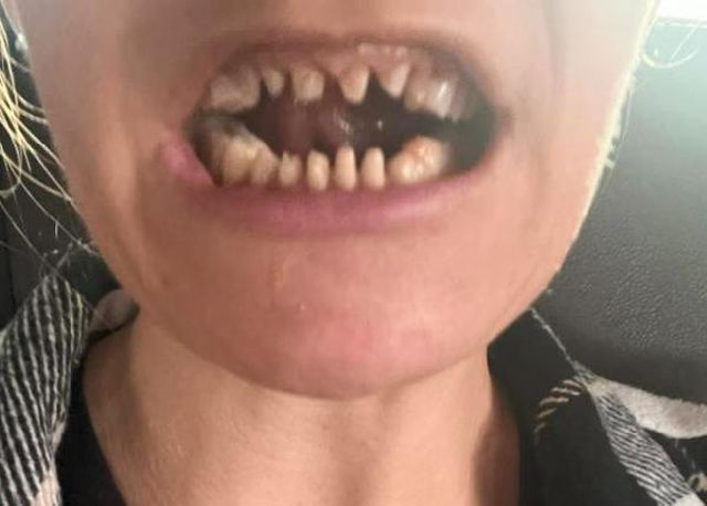 Danimarkalı kız kardeşler İstanbul'da Suriyelilere ait kaçak diş merkezinde ameliyat oldu! Sonrası kabus Danimarkalı kız kardeşler İstanbul'da Suriyelilere ait kaçak diş merkezinde ameliyat oldu! Sonrası kabus