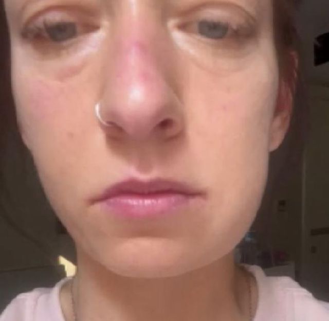 Danimarkalı kız kardeşler İstanbul'da Suriyelilere ait kaçak diş merkezinde ameliyat oldu! Sonrası kabus Danimarkalı kız kardeşler İstanbul'da Suriyelilere ait kaçak diş merkezinde ameliyat oldu! Sonrası kabus