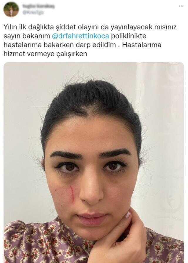 Hastanede saldırıya uğrayan kadın doktor Bakan Koca'ya böyle seslendi: Yayınlayacak mısınız sayın bakanım?