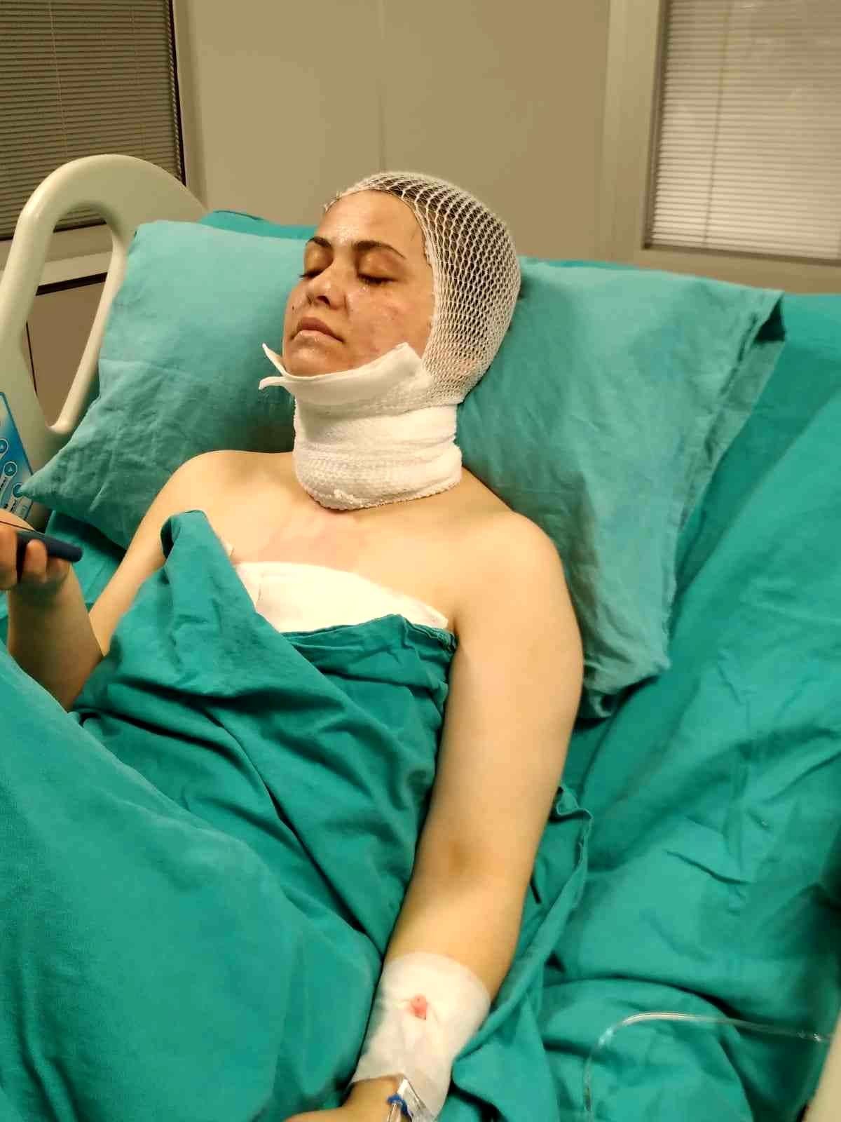 BAYRAMPAŞA\'DA ESKİ EŞE KİMYASAL MADDELİ SALDIRI