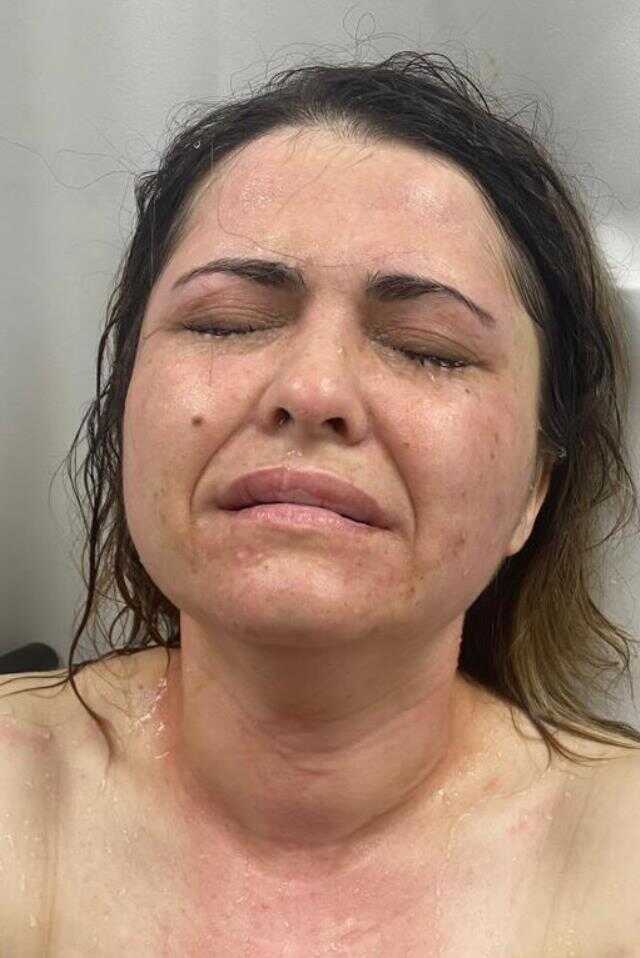 Eski kocası yolunu kesip 'Güzelliğine mi güveniyorsun?' diyerek yüzüne kimyasal madde fırlattı