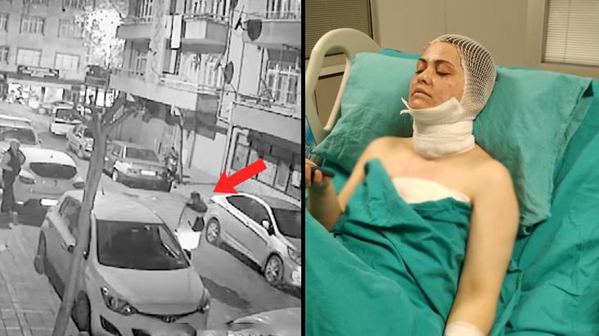 Eski kocası yolunu kesip 'Güzelliğine mi güveniyorsun?' diyerek yüzüne kimyasal madde fırlattı
