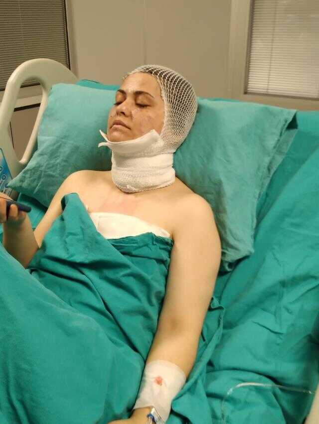 Eski kocası yolunu kesip 'Güzelliğine mi güveniyorsun?' diyerek yüzüne kimyasal madde fırlattı
