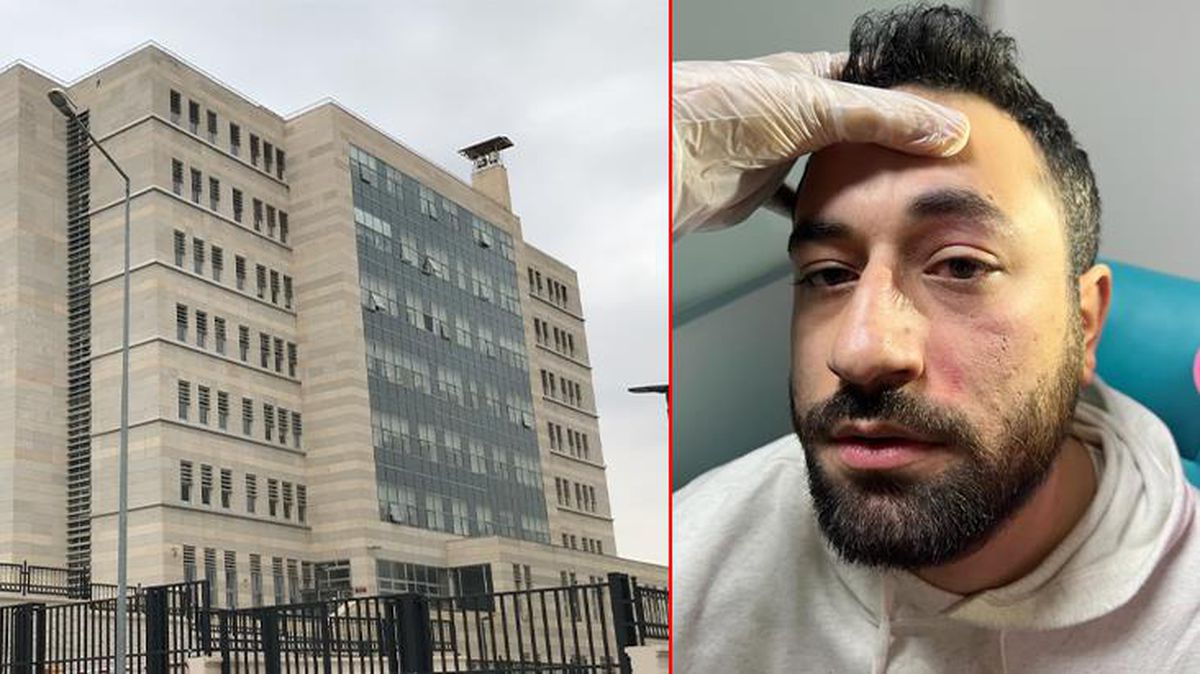 Randevusuna geç kalıp doktoru darbeden saldırgan, serbest bırakıldı