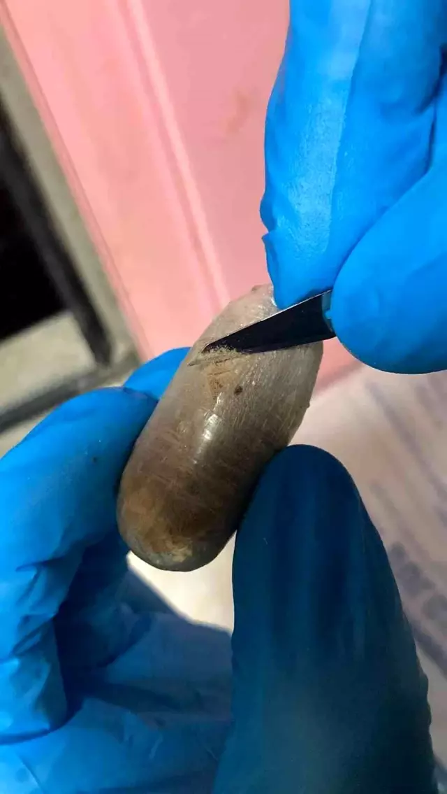 İhbar üzerine durdurulan otobüsteki yolcunun midesinden 76 paket uyuşturucu madde çıktı