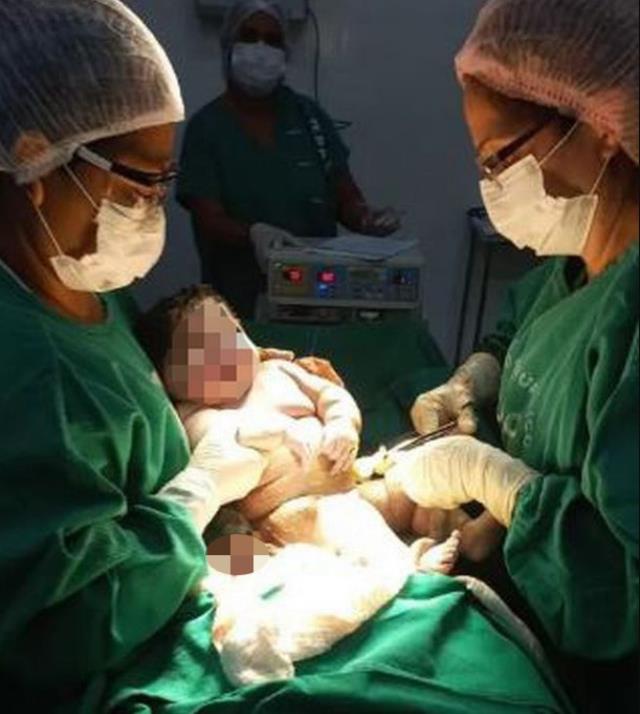 7 kilogram dünyaya gelen bebek doktorları bile şaşırttı! Yarım metreden fazla da boyu var