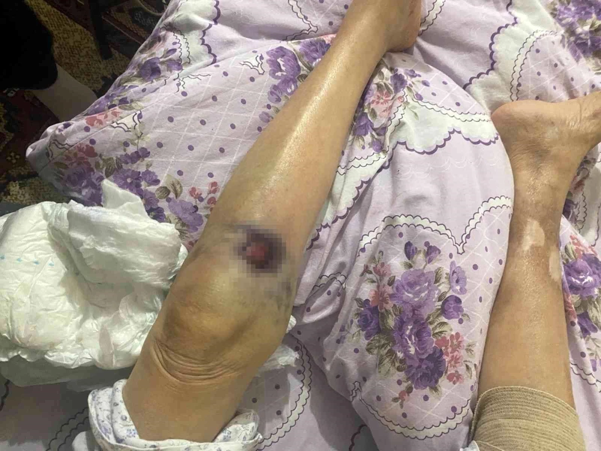 Ankara\'da bakıcı dehşeti: 91 yaşındaki yaşlı kadın hastanede ölüm kalım savaşı veriyor