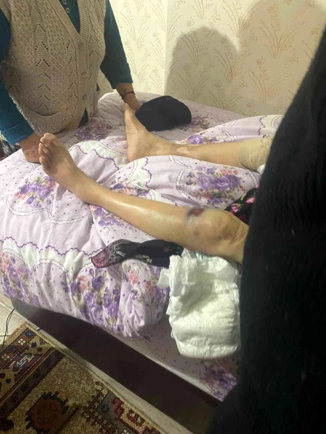 Başkent'te bakıcı dehşeti: 91 yaşındaki yaşlı kadın hastanede ölüm kalım savaşı veriyor