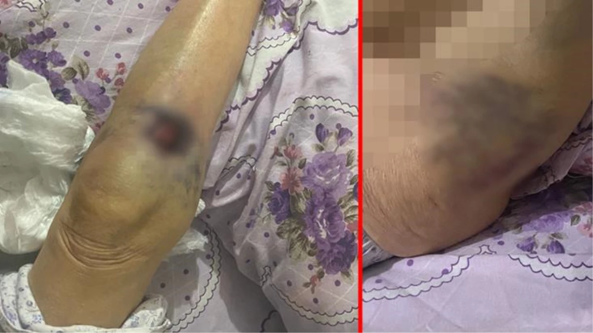 Başkent\'te bakıcı dehşeti: 91 yaşındaki yaşlı kadın hastanede ölüm kalım savaşı veriyor