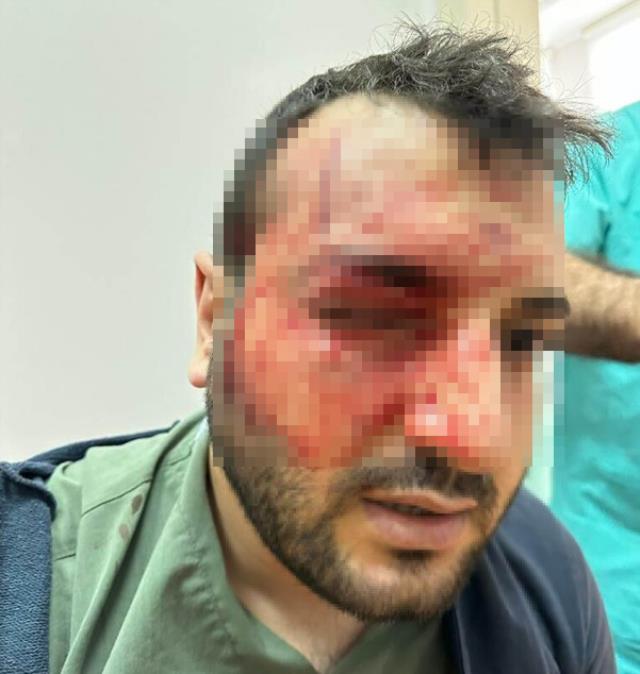 Balıkesir'de hastanede doktor kavgası! Ameliyatta başlayan tartışma kanlı bitti