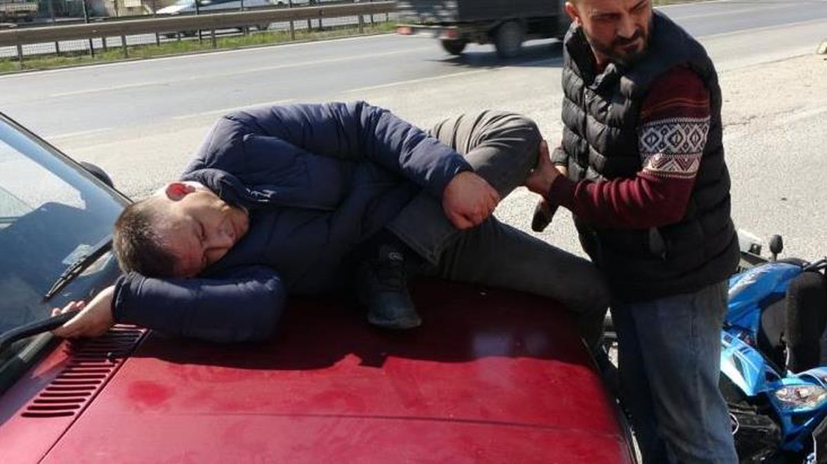 Otomobille motosiklet çarpıştı, sürücüsünün bacağı dizinden ters döndü