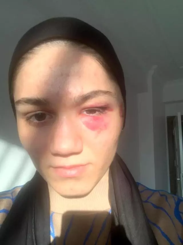 Depremden dolayı köye dönen ailenin, akrabaları tarafından darp edildiği iddiası