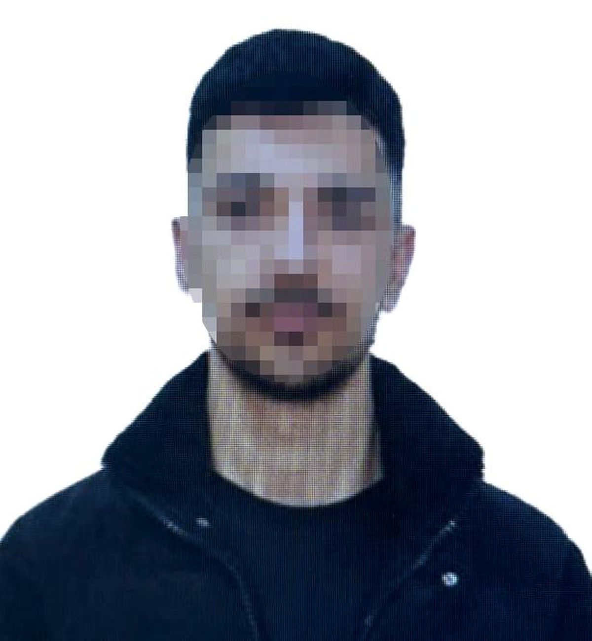 21 yaşındaki genç kadın eski sevgilisi tarafından kezzapla yaralandı