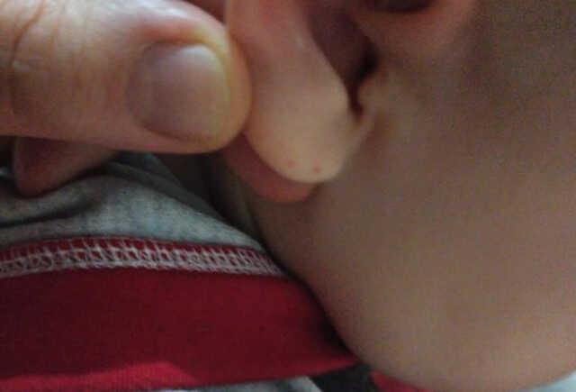 E ve balkon kapısından giren yarasa iki çocuğun kulağını ısırdı