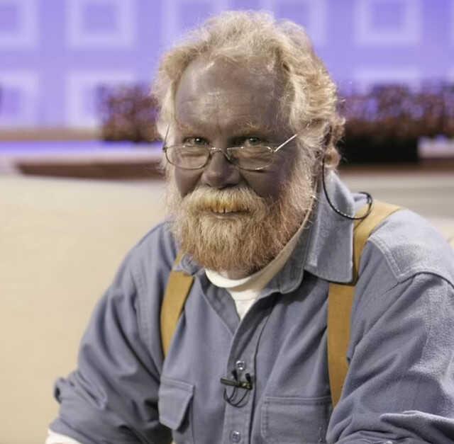 2013 yılında ölmüştü! Kendi yaptığı ilaçlardan rengi maviye dönüşen adamın fotoğrafları yayınlandı