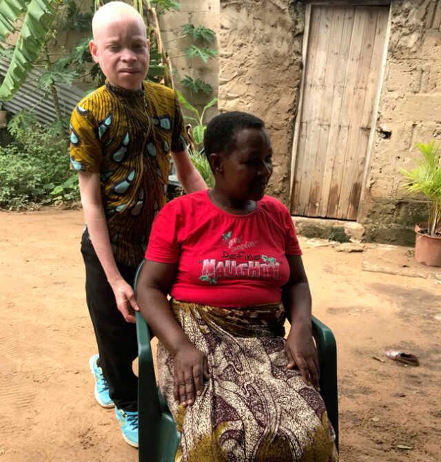 Mozambik'te büyücülükte kullanılması amacıyla albinos bir adamın cesedi çalındı