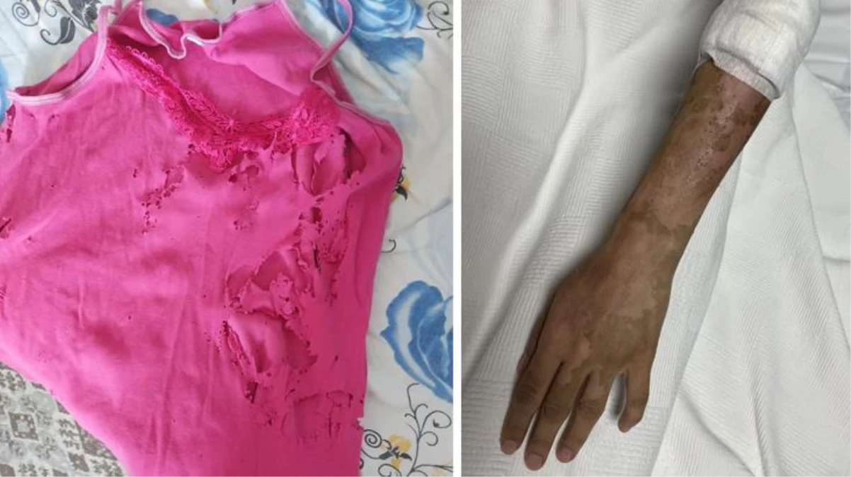 Lavabo açıcı bir anda patladı! Kıyafetlerine sıçrayan parçalar yüzünden acılar içinde kalan genç kadın hastaneye kaldırıldı