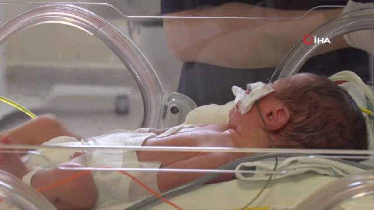 Prematüre bebek başarısı: 540 bebekten yüzde 95\'i hayata tutundu