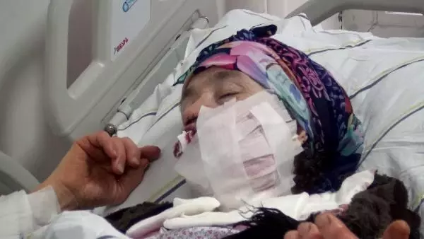 6 çocuk annesi Destegül canını kurtarmak için dakikalarca kurtla boğuştu