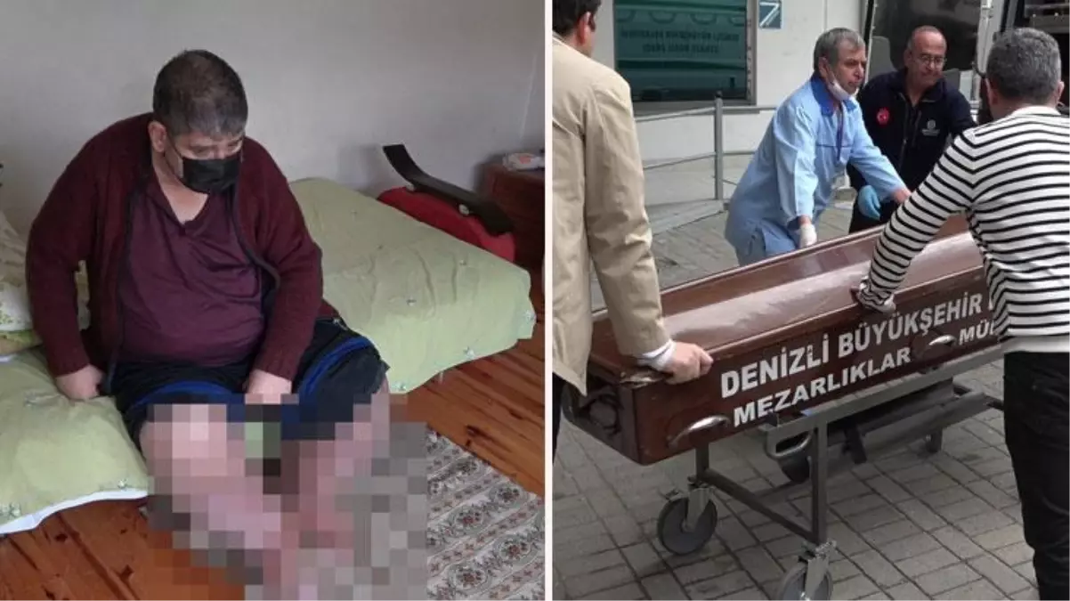 'Dayanacak gücüm kalmadı' diyen fil ayağı hastası Karaoğlanoğlu, yaşamını yitirdi