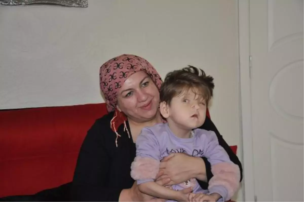 Fraser Sendromu Hastası Sevgi Hira Şahin\'in Hayat Mücadelesi