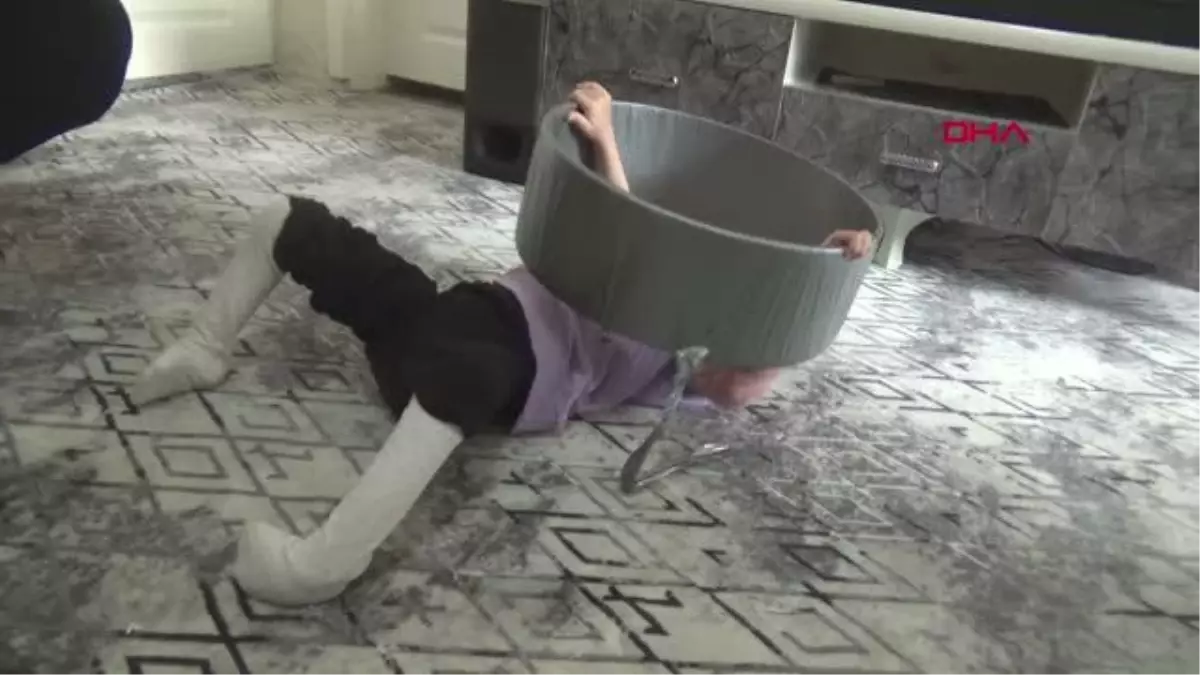 Fraser Sendromlu Sevgi Hira Şahin\'in Hayata Tutunma Mücadelesi