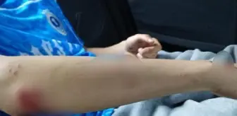 Zonguldak'ta sokak köpekleri lise öğrencisine saldırdı