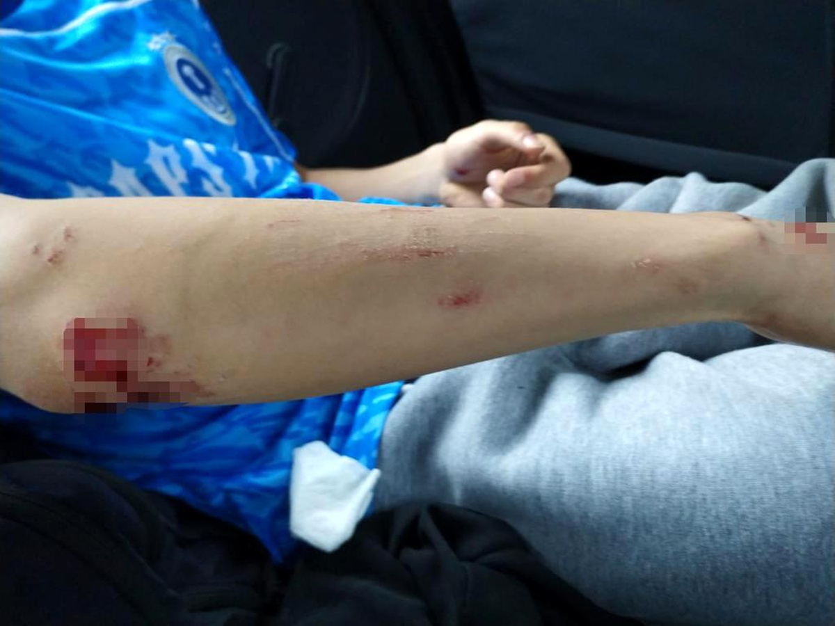 Zonguldak\'ta sahipsiz köpeklerin saldırısına uğrayan çocuk hastaneye kaldırıldı