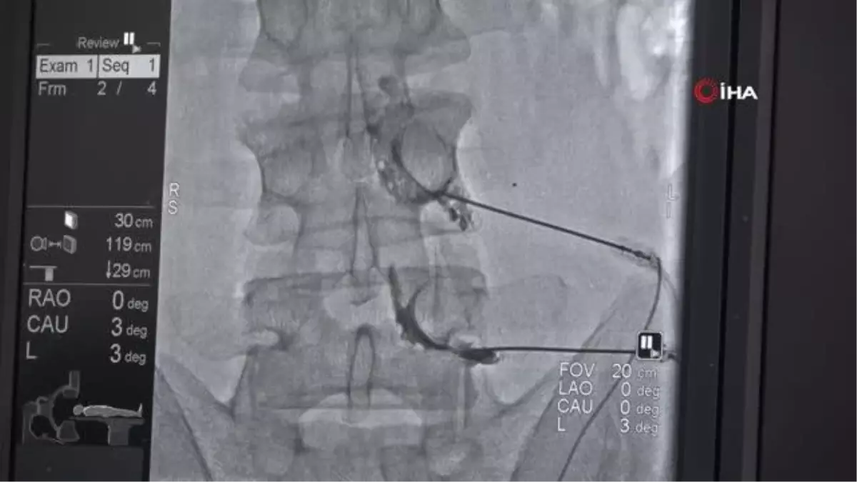 Van\'da kronik ağrılar tedavi ediliyor: "Hastanın ameliyat olmasına ve ilaç kullanmasına gerek kalmıyor"