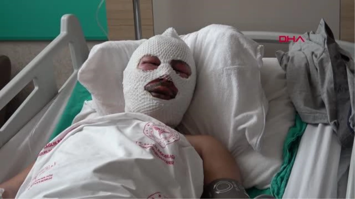 Ardahan\'da Zift Tankı Patlaması: Yaralanan İşçi Anlattı
