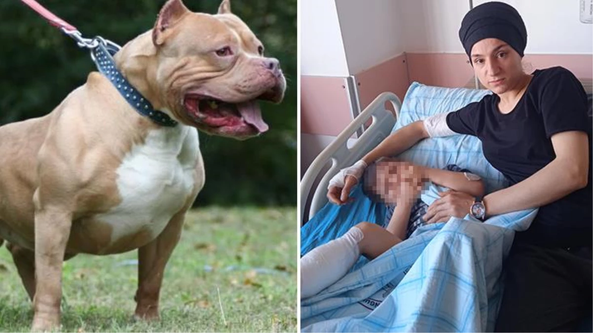 Pitbull saldırısıyla hastanelik olan 5 yaşındaki çocuk ölümden döndü