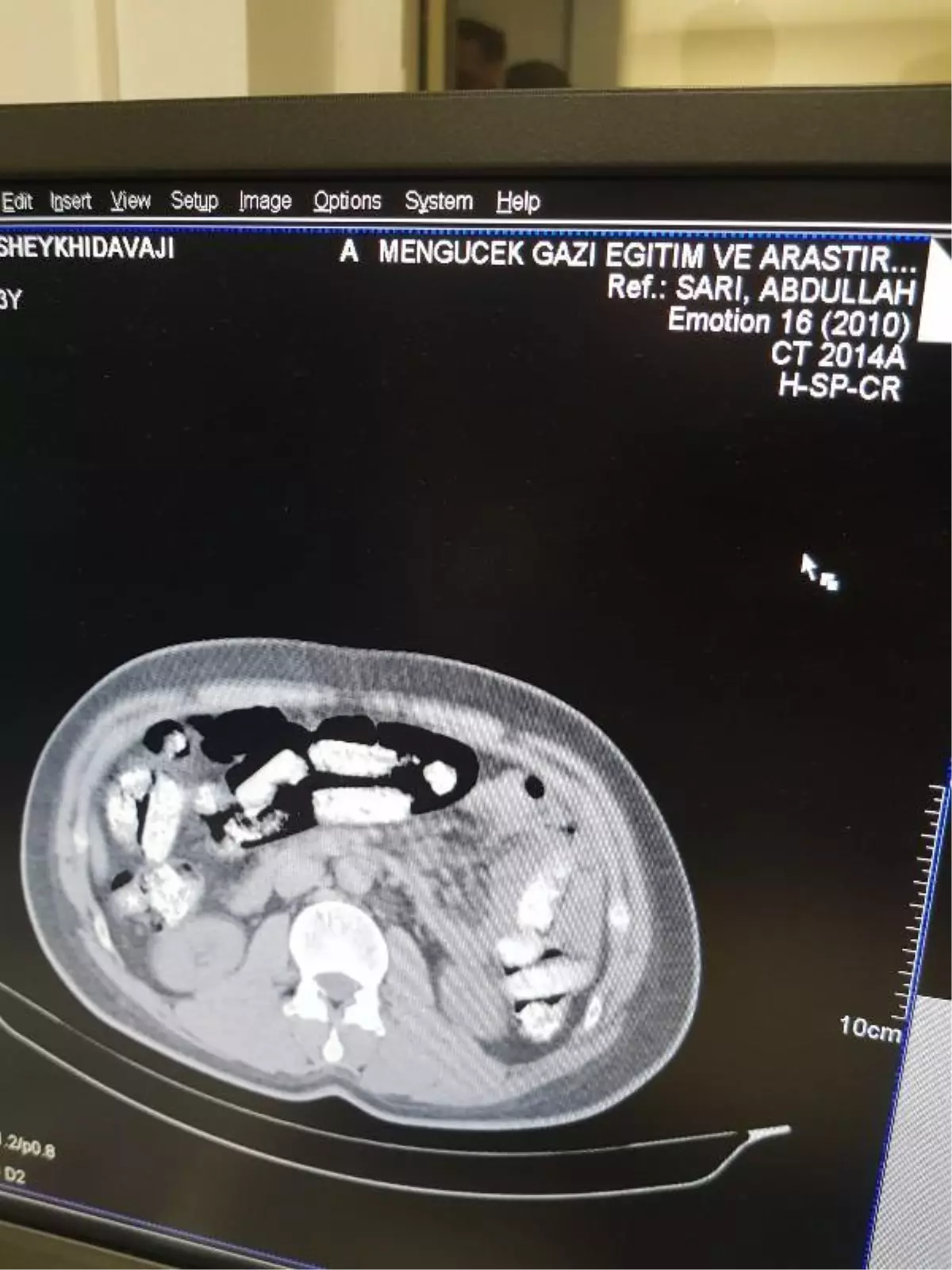 İran Plakalı Otobüste 1 Kilo 198 Gram Afyon Sakızı Bulundu