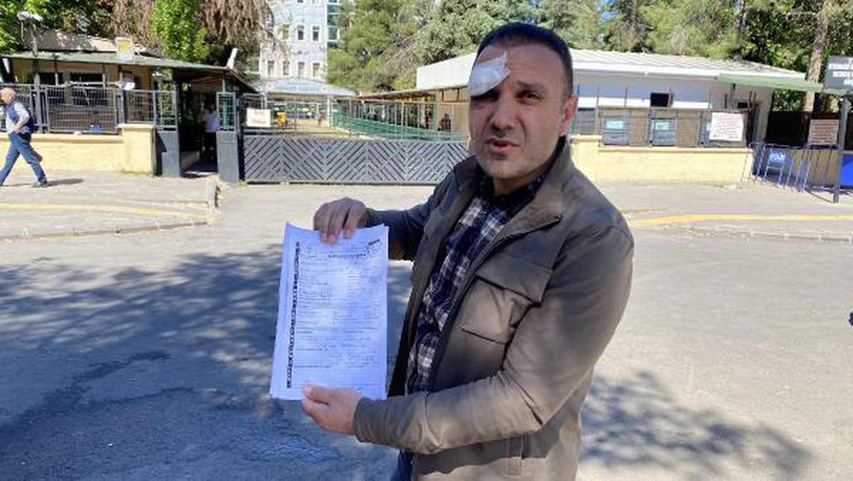 Otomobil Satın Alma İşlemi Sırasında Darp ve Gaspa Uğrayan Kişi Şikayetçi Oldu