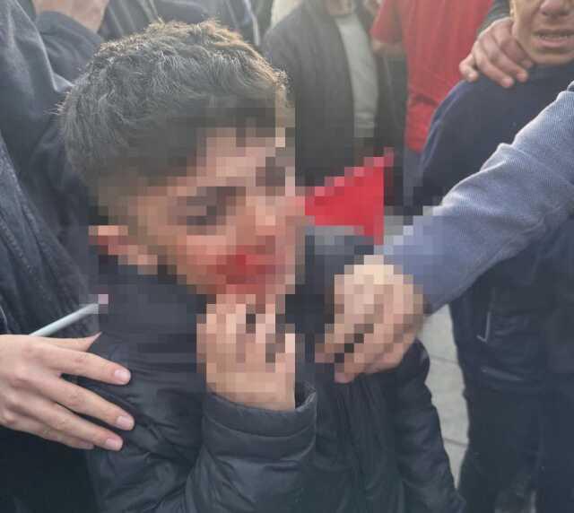 Erzurum Valisi Memiş'ten İmamoğlu'na taşlı saldırıyla ilgili açıklama: İhtiyaç olursa gözaltı yapılabilir Erzurum Valisi Memiş'ten İmamoğlu'na taşlı saldırıyla ilgili açıklama: İhtiyaç olursa gözaltı yapılabilir