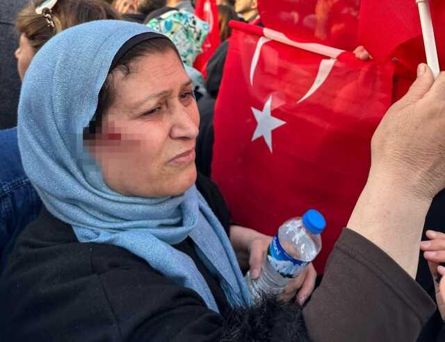 Erzurum Valisi Memiş'ten İmamoğlu'na taşlı saldırıyla ilgili açıklama: İhtiyaç olursa gözaltı yapılabilir Erzurum Valisi Memiş'ten İmamoğlu'na taşlı saldırıyla ilgili açıklama: İhtiyaç olursa gözaltı yapılabilir