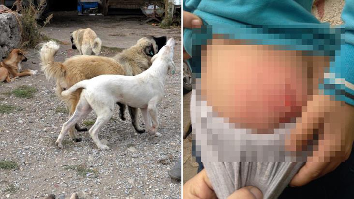 10 yaşındaki küçük çocuğa başıboş sokak köpekleri saldırdı