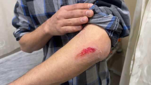 Yer Şanlıurfa! Başıboş sokak köpekleri, otobüs bekleyen gence saldırdı