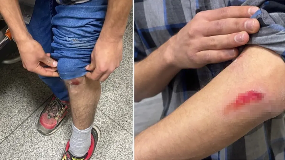 Yer Şanlıurfa! Başıboş sokak köpekleri, otobüs bekleyen gence saldırdı