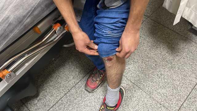 Yer Şanlıurfa! Başıboş sokak köpekleri, otobüs bekleyen gence saldırdı