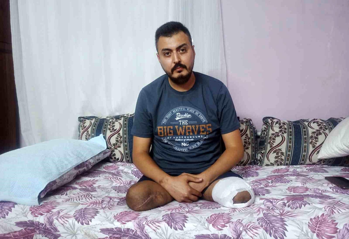 Depremde Eşini ve Çocuklarını Kaybeden Baba Protez Bacakla Yaşama Tutunmak İstiyor