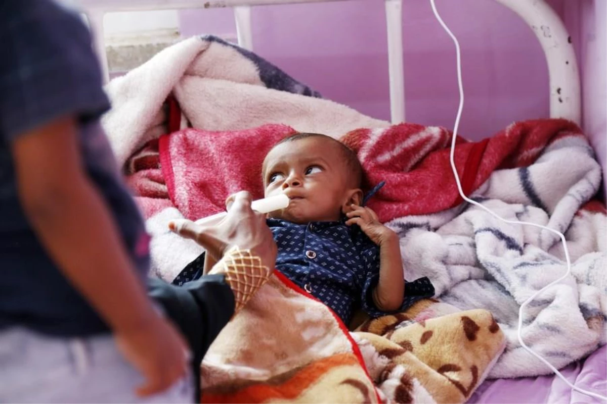 Yemen\'deki Gıda Güvensizliği Çocuklar İçin Tehdit Oluşturmaya Devam Ediyor