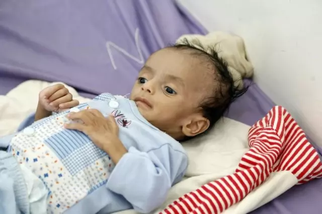 Gıda Güvensizliği Yemenli Çocuklar İçin Tehdit Oluşturmaya Devam Ediyor