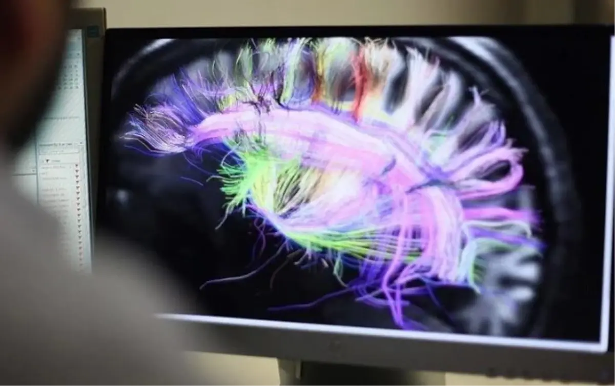 Dopamin nedir? Dopamin ne işe yarar?