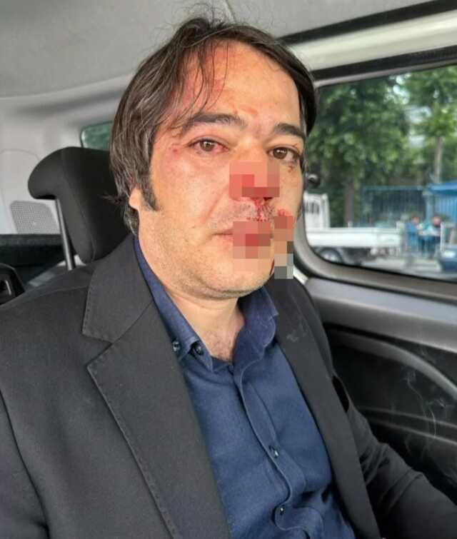 Üsküdar'da kaçak kafe yıkımı sırasında İBB İmar Şube Müdürü'ne saldırı: 1 kişi tutuklandı Üsküdar'da kaçak kafe yıkımı sırasında İBB İmar Şube Müdürü'ne saldırı: 1 kişi tutuklandı